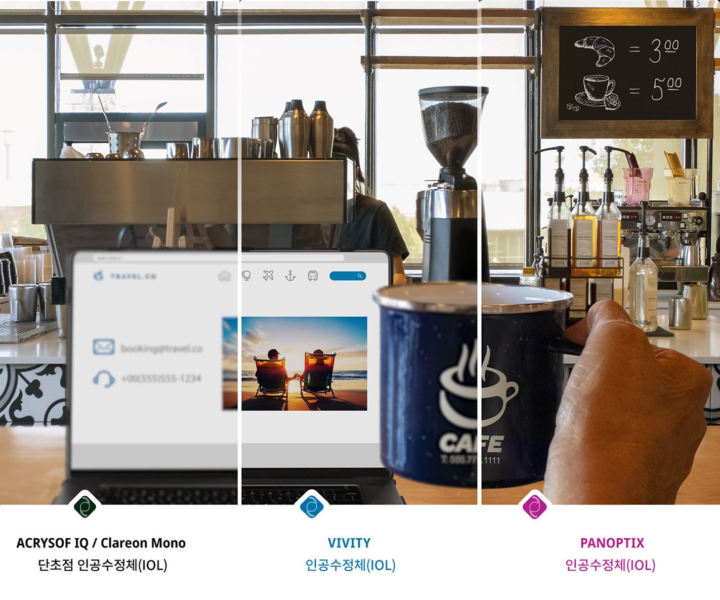 Coffee shop with a view from the counter of coffee machinesand other ingredients. A laptop is open on the countertop and an individual’s hand holds up a coffee mug to the right of the laptop screen.The image is split into 4 sections to show the difference between an individual’s vision quality with cataracts versus vision with a Monofocal Lens, Acrysof IQ Vivity® IOL, oranAcrysof® IQ PanOptix® IOL. The far-left section of the image is blurry with a yellow tinge to illustrate duller vision associated with cataracts. The 3 remaining sections are significantly clearer to show the visual benefits of using an IOL option to treat cataracts.