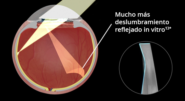 An internal image of an eye implanted with straight edge IOL over a black background. As light enters the eyes, the visual depicts significantly more reflected glare in vitro. An image in another bubble highlights the precision edge design of a straight edge IOL.