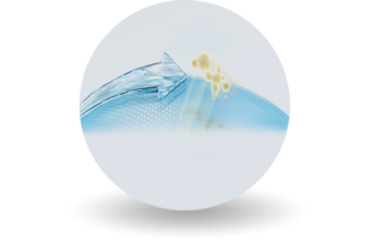 Smartshield technology