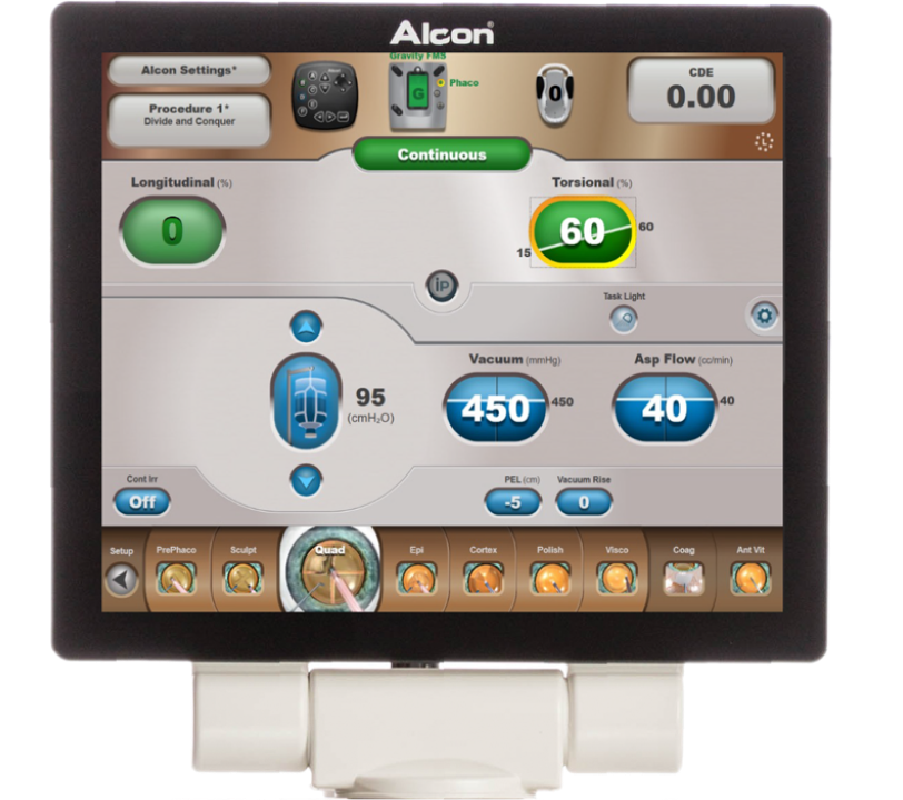 An image of the CENTURION Silver System graphic user interface