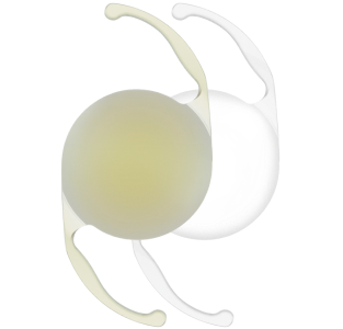 An image of two AcrySof IQ Monofocal IOLs. The IOL on the left is yellow in colour and the IOL on the right is clear.