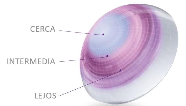 Precision profile