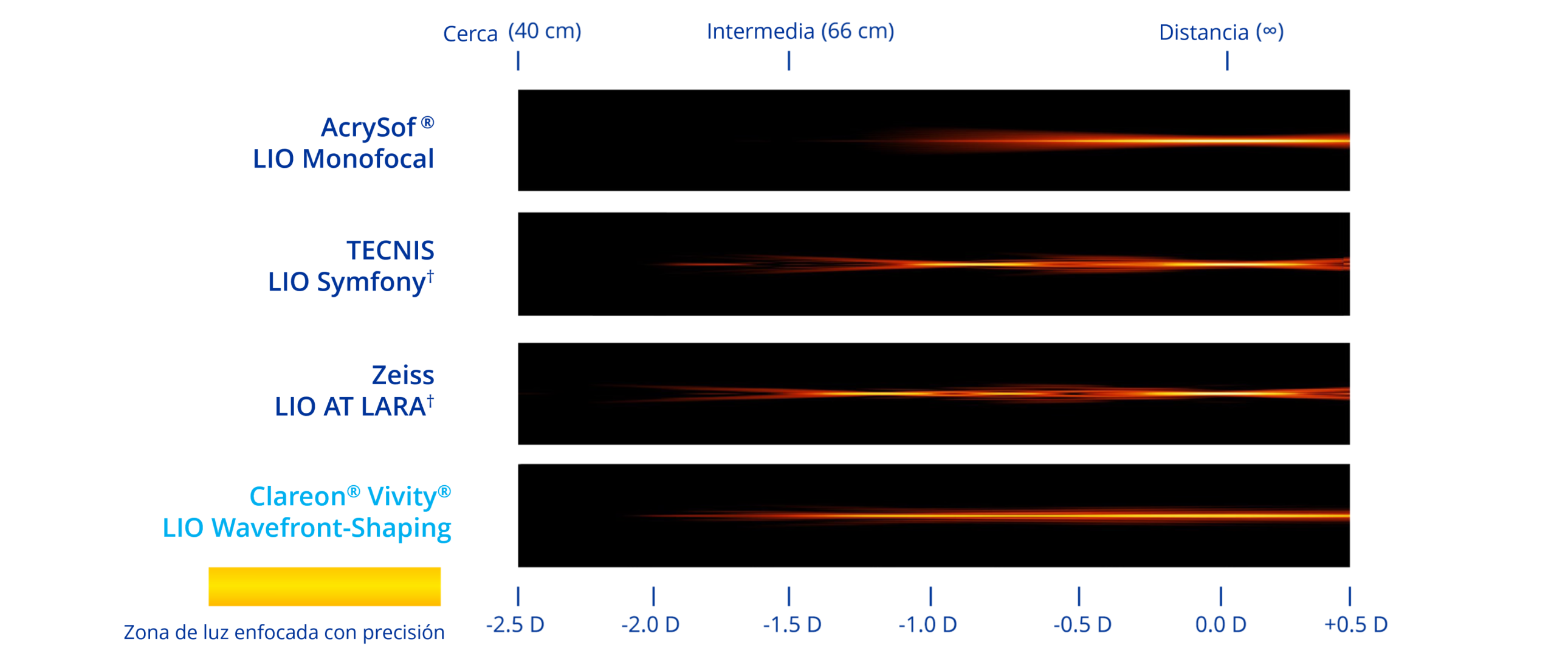A graphic illustrating the simulated range of vision based on light intensity distribution with four different IOLs. The Clareon monofocal IOL provides distance vision. The TECNIS Symfony IOL provides distance, intermediate and near vision. The Zeiss AT LARA IOL provides vision at distance and two intermediate focal points. The Clareon Vivity IOL provides a continuous range of vision from distance to functional near.