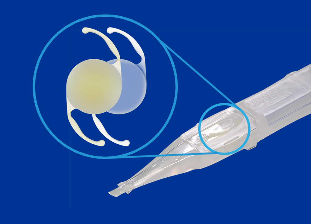 UltraSert Preloaded Delivery System with a circle over the device to indicate where you would input the AcrySof IQ IOL. A close-up 3-dimensional image of two IOLs sit to the left the UltraSert Delivery System.