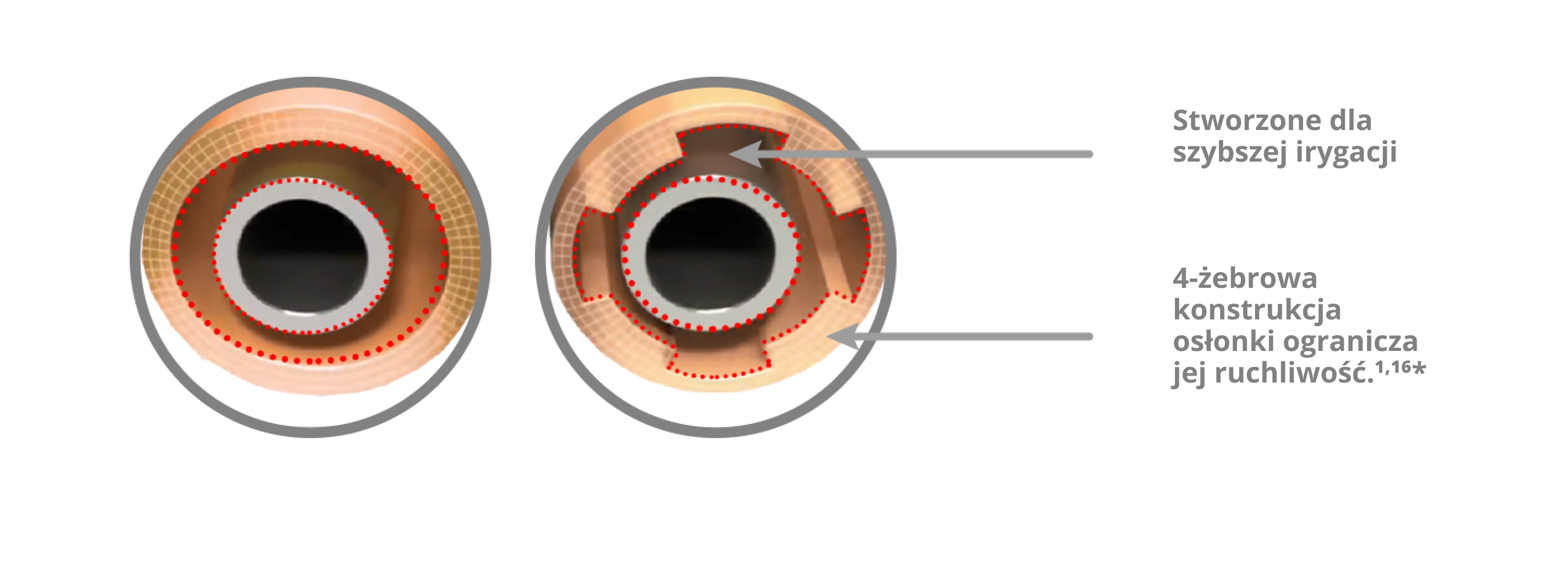 An image of that showcases the INTREPID irrigation sleeve with a 4-rib sleeve design which reduces sleeve movement and increases irrigation flow compared to the INFINITI Vision System
