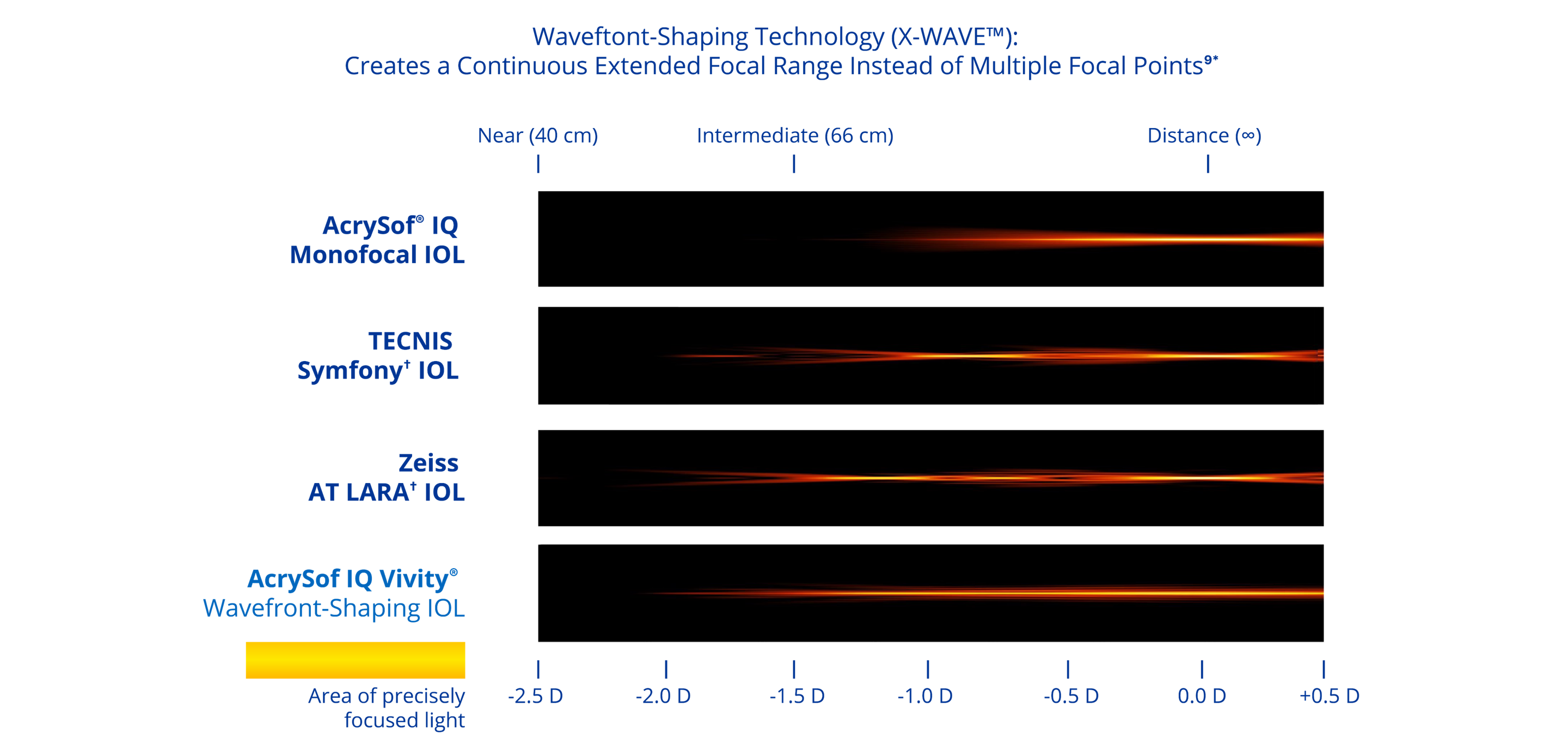 A graphic illustrating the range of vision with four different IOLs. The AcrySof® IQ monofocal IOL provides distance vision. The Symfony IOL provides distance, intermediate and near vision. The AT LARA IOL provides vision at distance and two intermediate focal points. The AcrySof IQ Vivity® IOL provides a continuous range of vision from distance to functional near.
