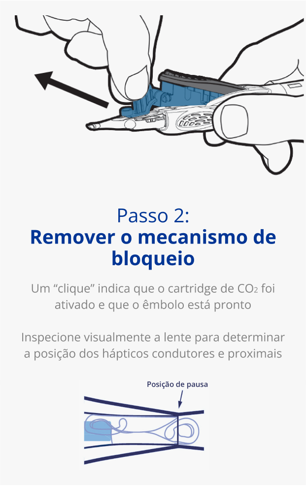 Ilustração de uma mão a segurar o Injetor AutonoMe. Uma seta preta aponta para fora do cartridge para indicar o movimento de puxar.  Ilustração do êmbolo/cartridge do Injetor AutonoMe. Uma seta azul escura aponta para a LIO dobrada no cartridge AutonoMe e pode ler-se “Local de pausa”. 