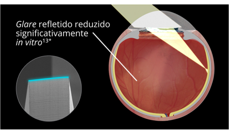 Uma imagem interna de um olho implantado com a LIO Clareon sobre um fundo preto. À medida que a luz penetra nos olhos, a ilustração indica um encandeamento refletido reduzido significativamente in vitro. Uma imagem noutro balão realça o design da borda da LIO Clareon.