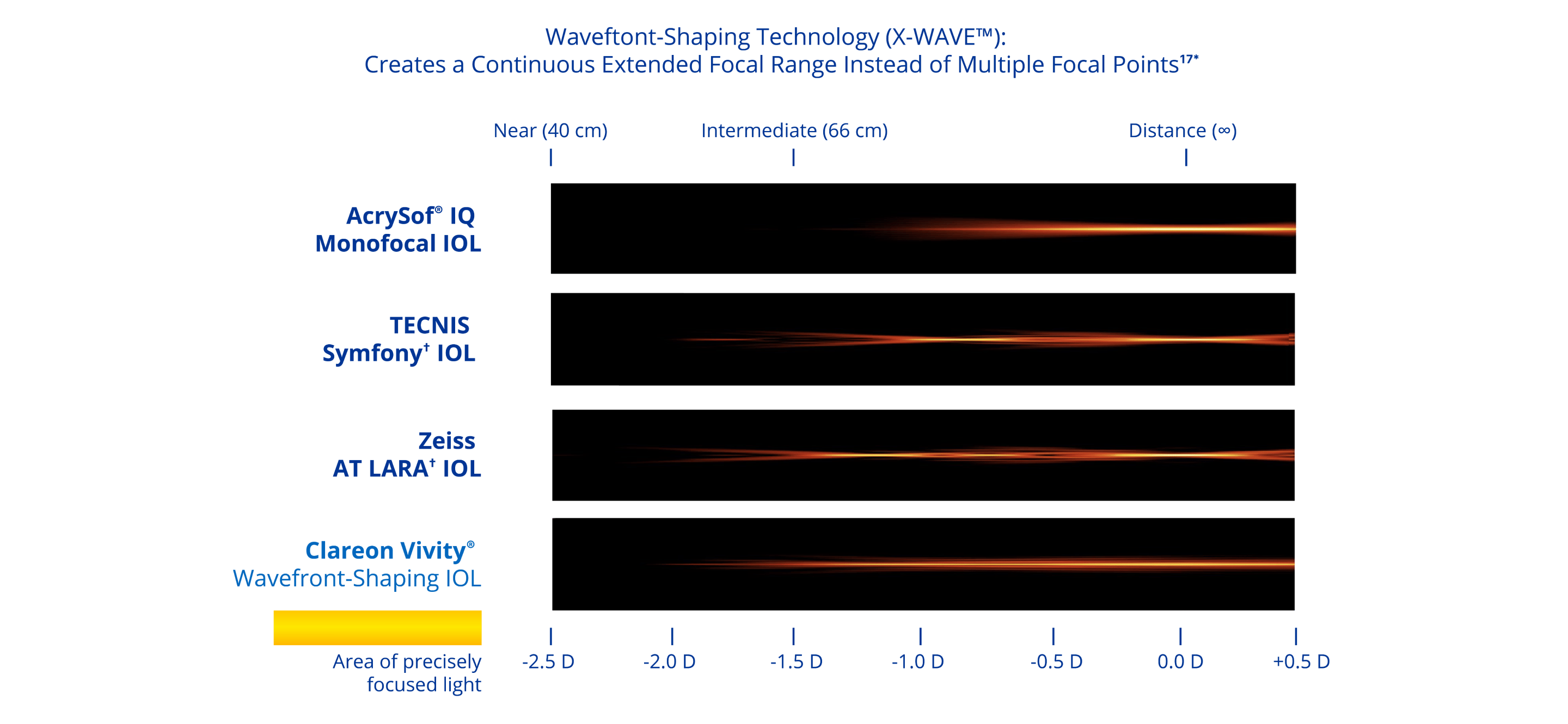 A graphic illustrating the simulated range of vision based on light intensity distribution with four different IOLs. The Clareon monofocal IOL provides distance vision. The TECNIS Symfony IOL provides distance, intermediate and near vision. The Zeiss AT LARA IOL provides vision at distance and two intermediate focal points. The Clareon Vivity IOL provides a continuous range of vision from distance to functional near.