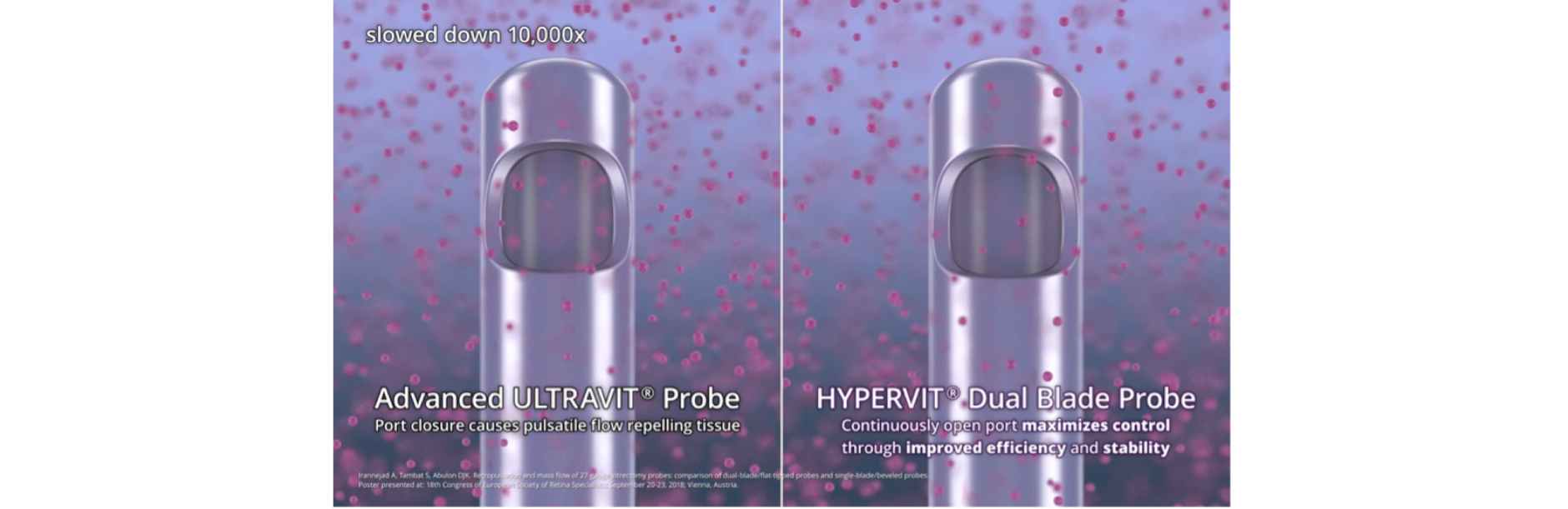O imagine generată pe computer cu vârful sondei Advanced ULTRAVIT pe stânga cu textul, „Închiderea portului cauzează un flux pulsatil care respinge țesutul”, iar sonda HYPERVIT cu lamă dublă în partea dreaptă cu textul, „Portul deschis continuu maximizează controlul prin eficiență sporită și stabilitate”. Sondele sunt înconjurate de o umoare vitroasă pentru a ilustra curgerea corpului vitros. Un buton de redare de culoare albă indică faptul că acesta este un video.