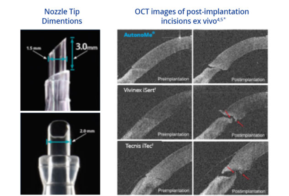Two related images beside each other. The first image is a close-up of the AutonoMe nozzle tip, with text indicating that the length of the tip is 3.0mm, and diameter of the tip is 2.0mm. Blue text at the top of this image reads “Nozzle Tip Dimensions.” The second image is of the pre- and post- implantation process for AutonoMe, Vivinex, and Tecnis. Blue text at the top of this image reads “OCT images of post-implantation incisions ex vivo.” Red arrows on top of the Vivinex and Tecnis images point to membrane tearing post implantation ex vivo.