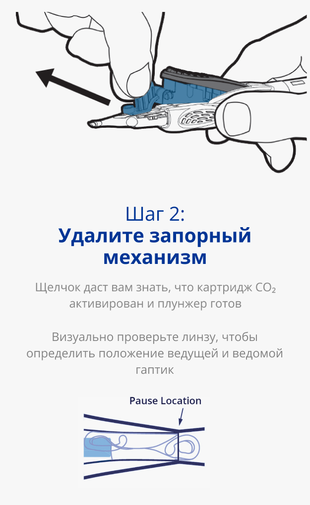 Иллюстрация руки, держащей систему AutonoMe Delivery System. Черная стрелка, направленная в сторону от картриджа устройства, указывает на тянущее движение. Иллюстрация плунжера/картриджа системы доставки AutonoMe. Темно-синяя стрелка указывает на сложенную ИОЛ в картридже AutonoMe с надписью 'Pause Location'.