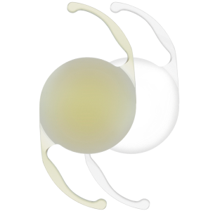An image of two AcrySof IQ Monofocal IOLs. The IOL on the left is yellow in colour and the IOL on the right is clear.