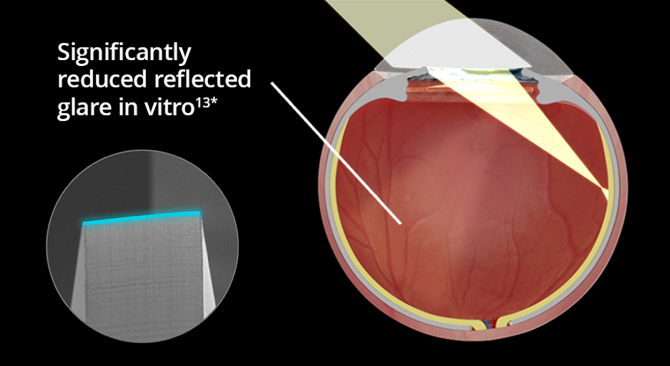 An internal image of an eye implanted with the Clareon IOL over a black background. As light enters the eyes, the visual depicts significantly reduced reflected glare in vitro. An image in another bubble highlights the edge design of the Clareon IOL.