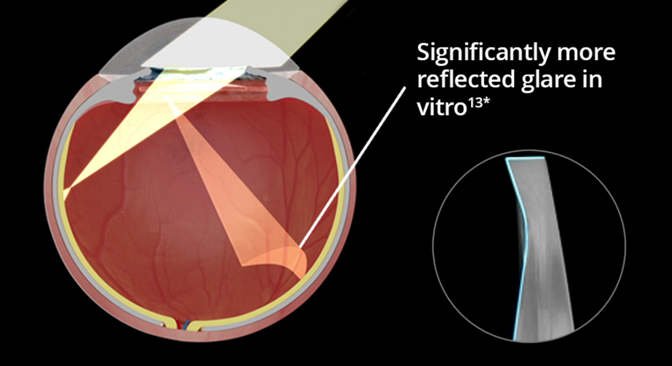 An internal image of an eye implanted with straight edge IOL over a black background. As light enters the eyes, the visual depicts significantly more reflected glare in vitro. An image in another bubble highlights the precision edge design of a straight edge IOL.