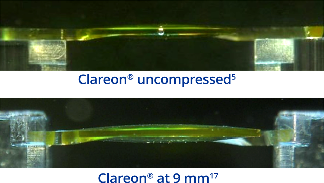 An image of the Clareon IOL from the side, depicting the shape of the IOL when uncompressed. An image of the Clareon IOL from the side, depicting the shape of the IOL with 9 mm compression.