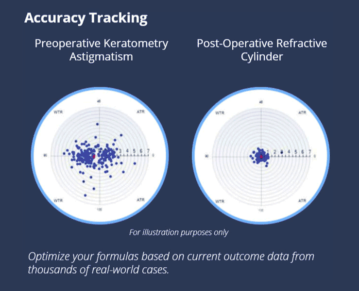 accuracy tracking