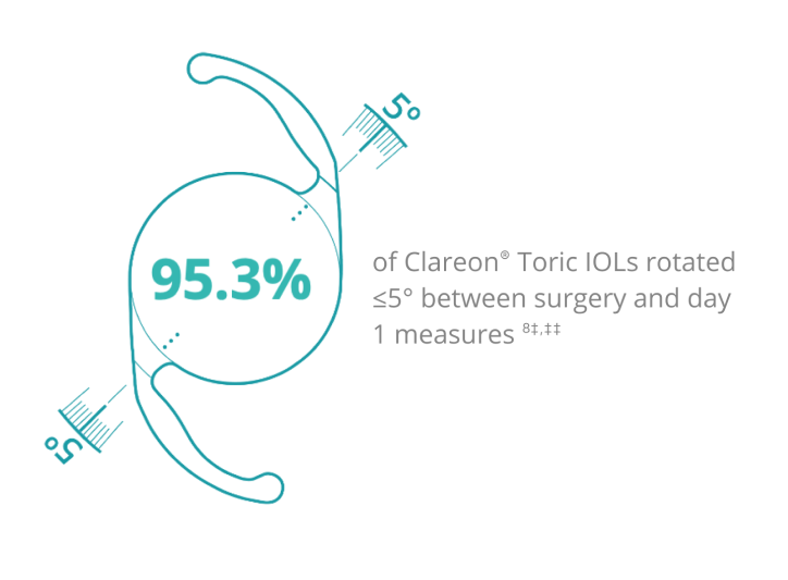 95.3% of Clareon Toric IOLs