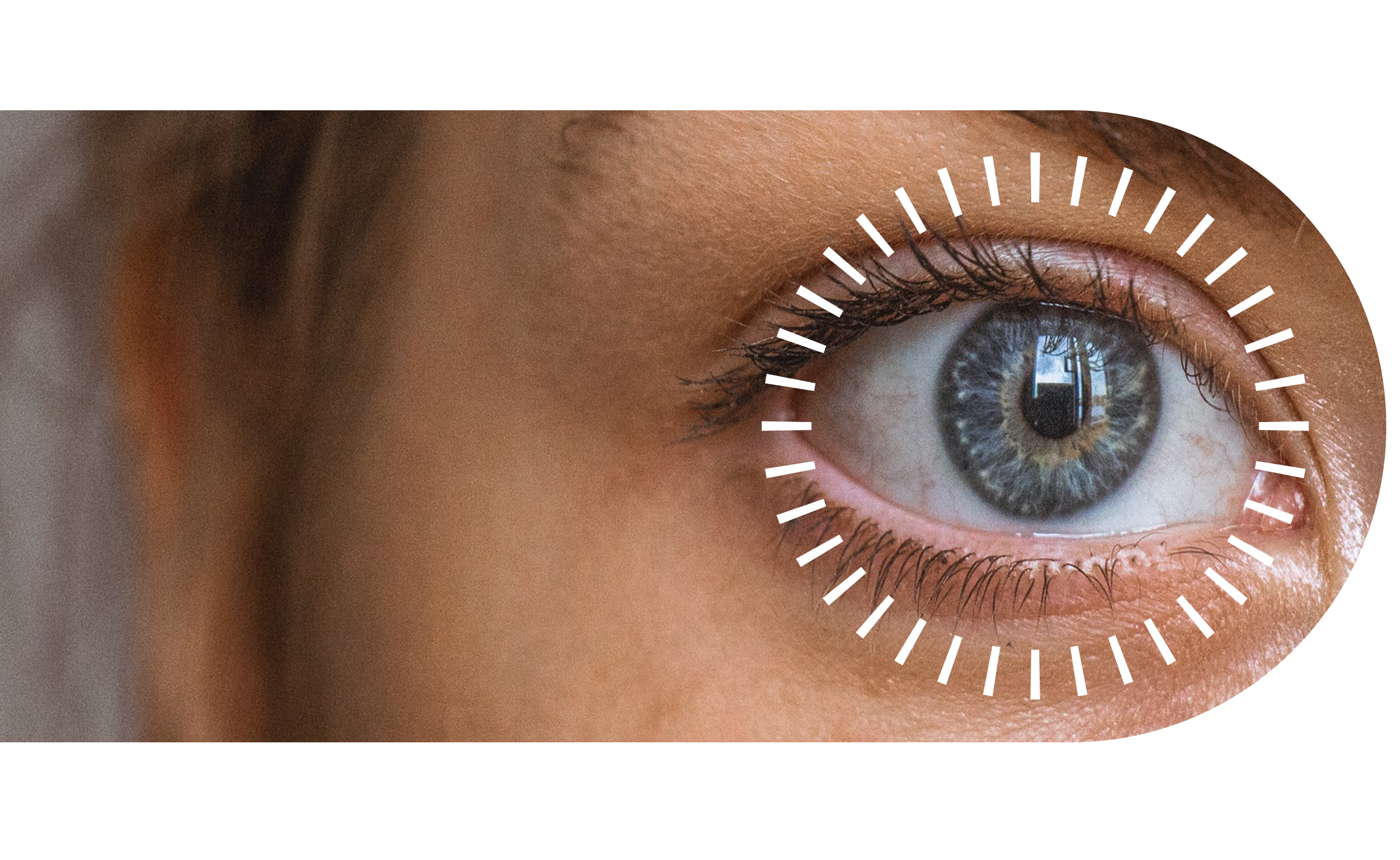 Close up of a woman's eye under the ORA System AnalyzOR Technology