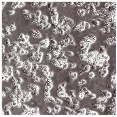 microscope slide of live acanthamoeba trophozoites