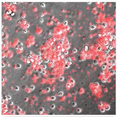 microscope slide showing high amounts of red stains on Acanthamoeba trophozoites, proving Acanthamoeba cell death died with Propidium iodide