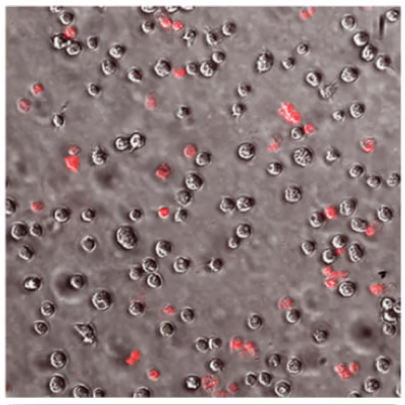 microscope slide showing low levels of red stains on Acanthamoeba trophozoites (ReNu Advanced Formula)