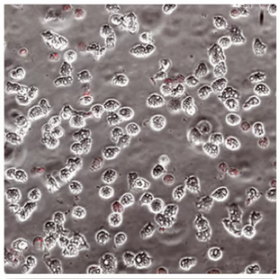 microscope slide showing low levels of red stains on Acanthamoeba trophozoites (ReNu Advanced Formula)