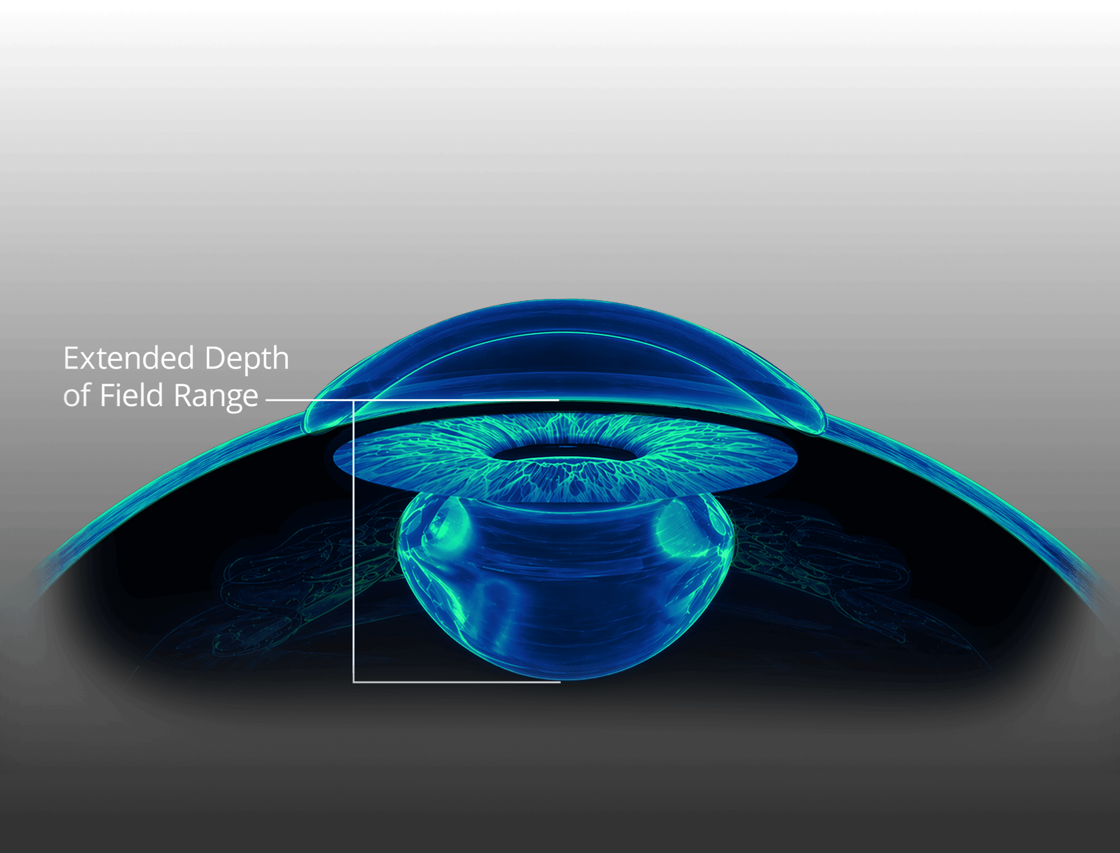 Illustration of an eye showing the extended depth of field range