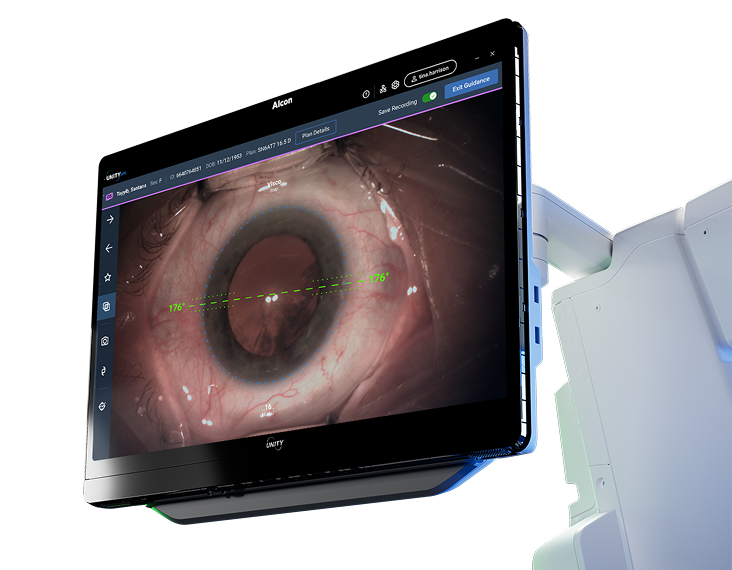 UNITY M display showing digital guidance during an ophthalmic procedure
