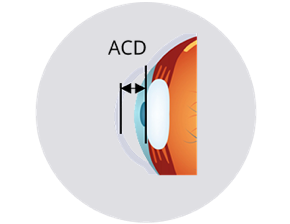 Anterior chamber depth and lens position image
