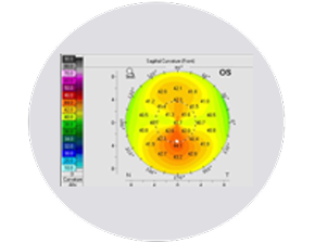 Anterior cornea image