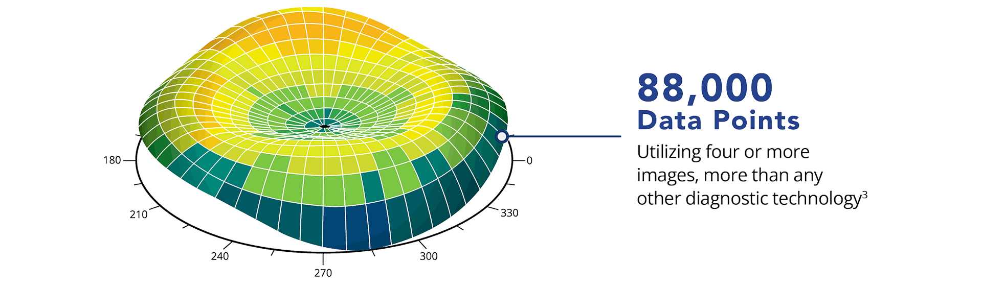 A colorful topographic-style diagram showing a 3D map of the corneal surface with the label “88,000 data points.”