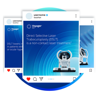Series of Voyager DSLT social media posts featuring messaging about non-contact laser treatment for glaucoma and images of the Voyager DSLT device