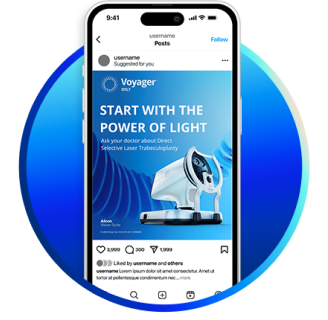 Smartphone screen displaying a social media post for Voyager DSLT with the message 'Start with the Power of Light' and an image of the glaucoma laser device
