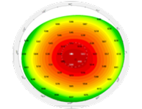 Pachymetry image