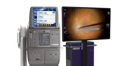 Alcon ophthalmic surgical system paired with a high-definition monitor displaying a close-up retinal procedure, showing precision instruments inside the eye.