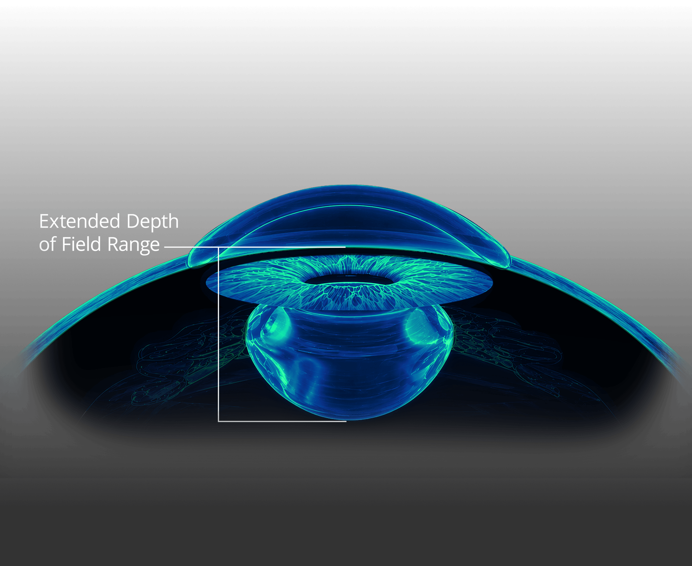 Illustration of an eye showing the extended depth of field range