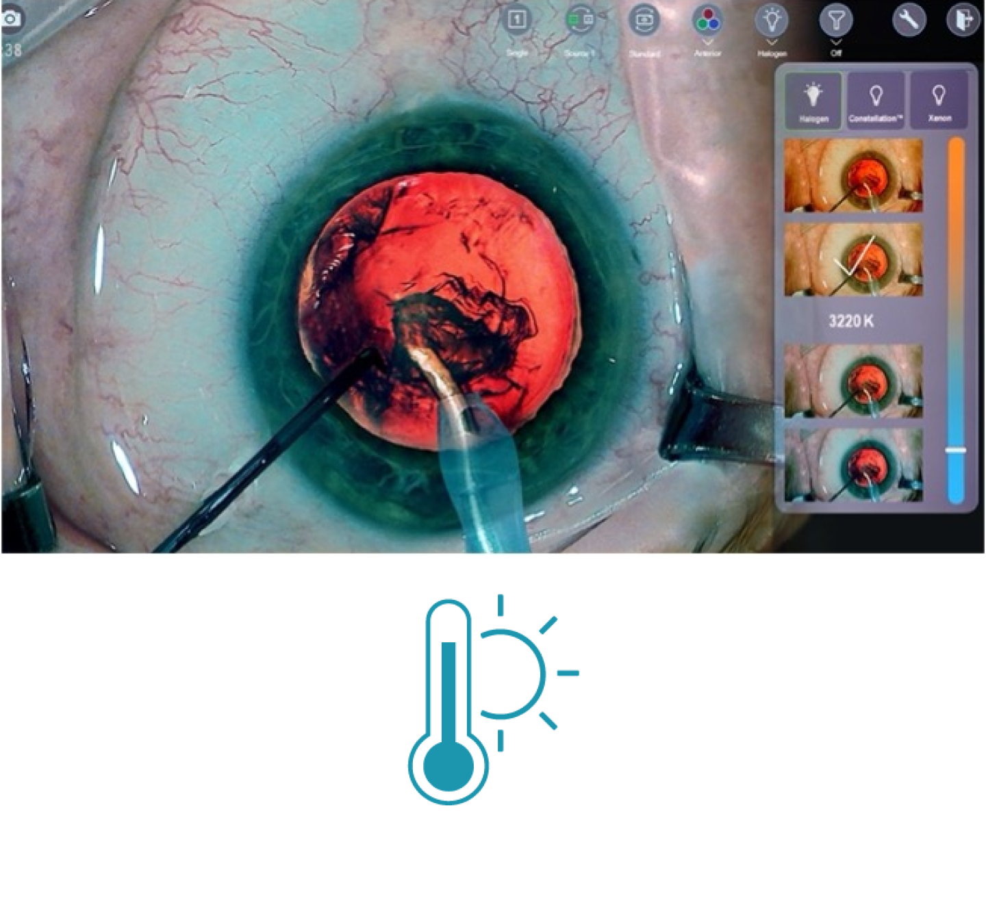 A closeup image of an eye during surgery with surgical tools on screen Thumbnails on the right side of the screen show the different light temperature filters available with NGENUITY 3D Visualization System.A blue icon showing a thermometer with the sun behind it 