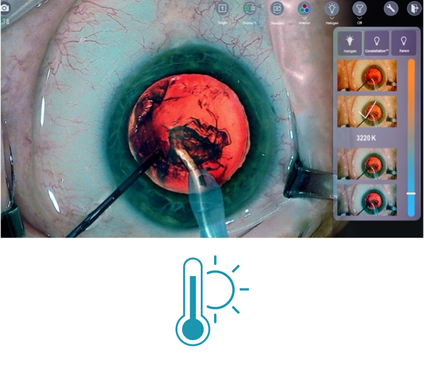 Image en gros plan d'un œil pendant une intervention chirurgicale avec des outils chirurgicaux à l'écran Les vignettes sur le côté droit de l'écran montrent les différents filtres de température de lumière disponibles avec le système de visualisation 3D NGENUITY.Une icône bleue représentant un thermomètre avec le soleil derrière lui
