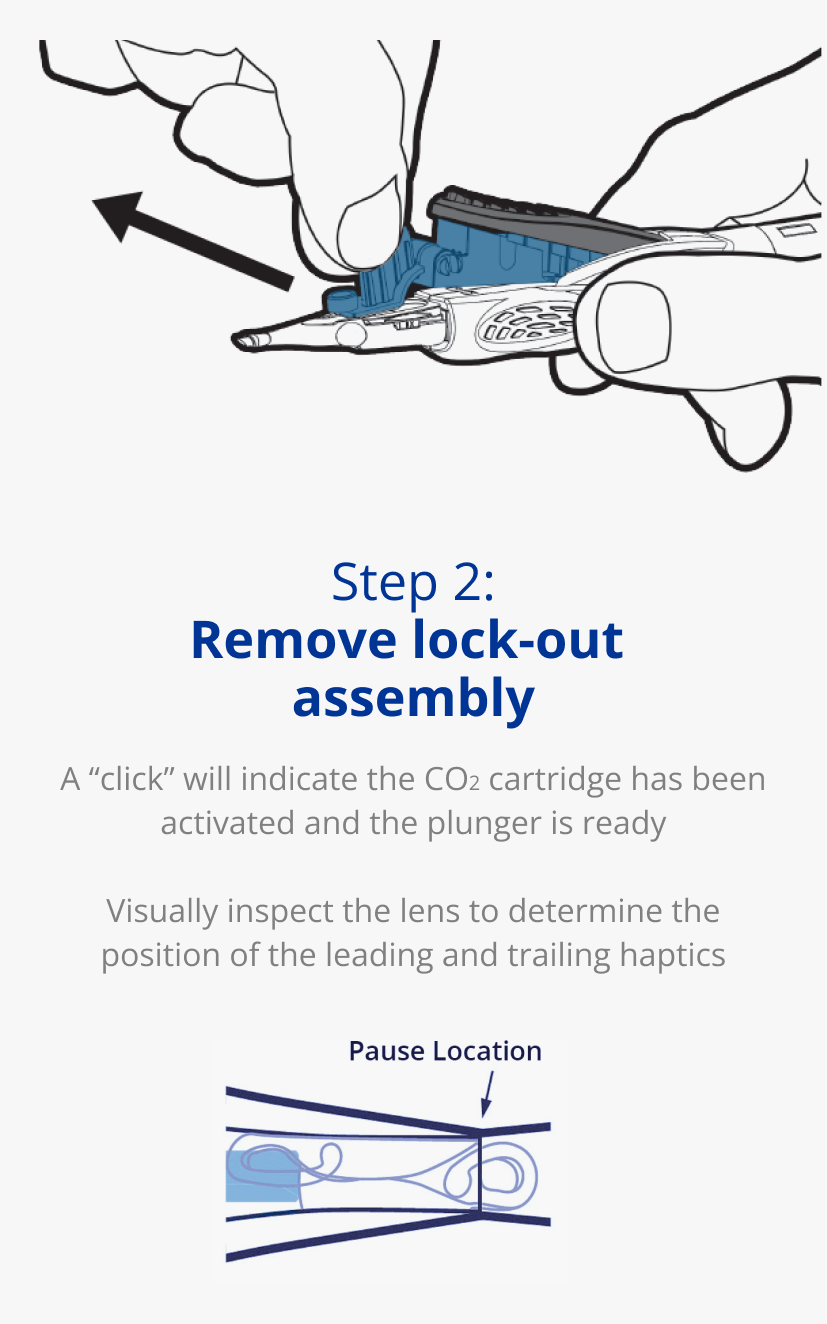 Illustration of an AutonoMe Delivery System’s plunger/cartridge piece. A dark blue arrow points towards the folded IOL in the AutonoMe cartridge with text that reads “Pause Location.”