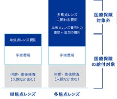単焦点レンズと多焦点レンズの費用を比較する図。単焦点レンズは、術前・術後検査(入院など含む)、手術費用、レンズ費用のすべてが医療保険の給付対象です。多焦点レンズは、単焦点レンズ費用との差額と追加の費用が医療保険の対象外となり、自己負担になります。