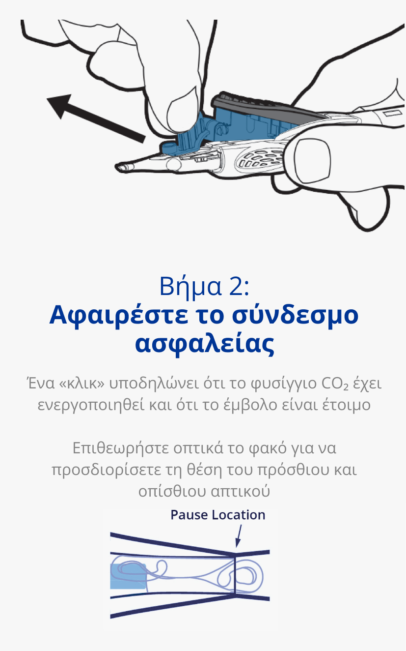 Απεικόνιση ενός χεριού που κρατά ένα σύστημα ένθεσης AutonoMe. Ένα μαύρο βέλος δείχνει την αποδέσμευση του συνδέσμου ασφαλείας του συστήματος μέσω μιας κίνησης έλξης. Απεικόνιση του εμβόλου/φυσιγγίου ενός συστήματος ένθεσης AutonoMe. Ένα σκούρο μπλε βέλος δείχνει προς τον διπλωμένο ενδοφακό εντός του ακροφυσίου του συτήματος AutonoMe με κείμενο που αναγράφει Pause location.