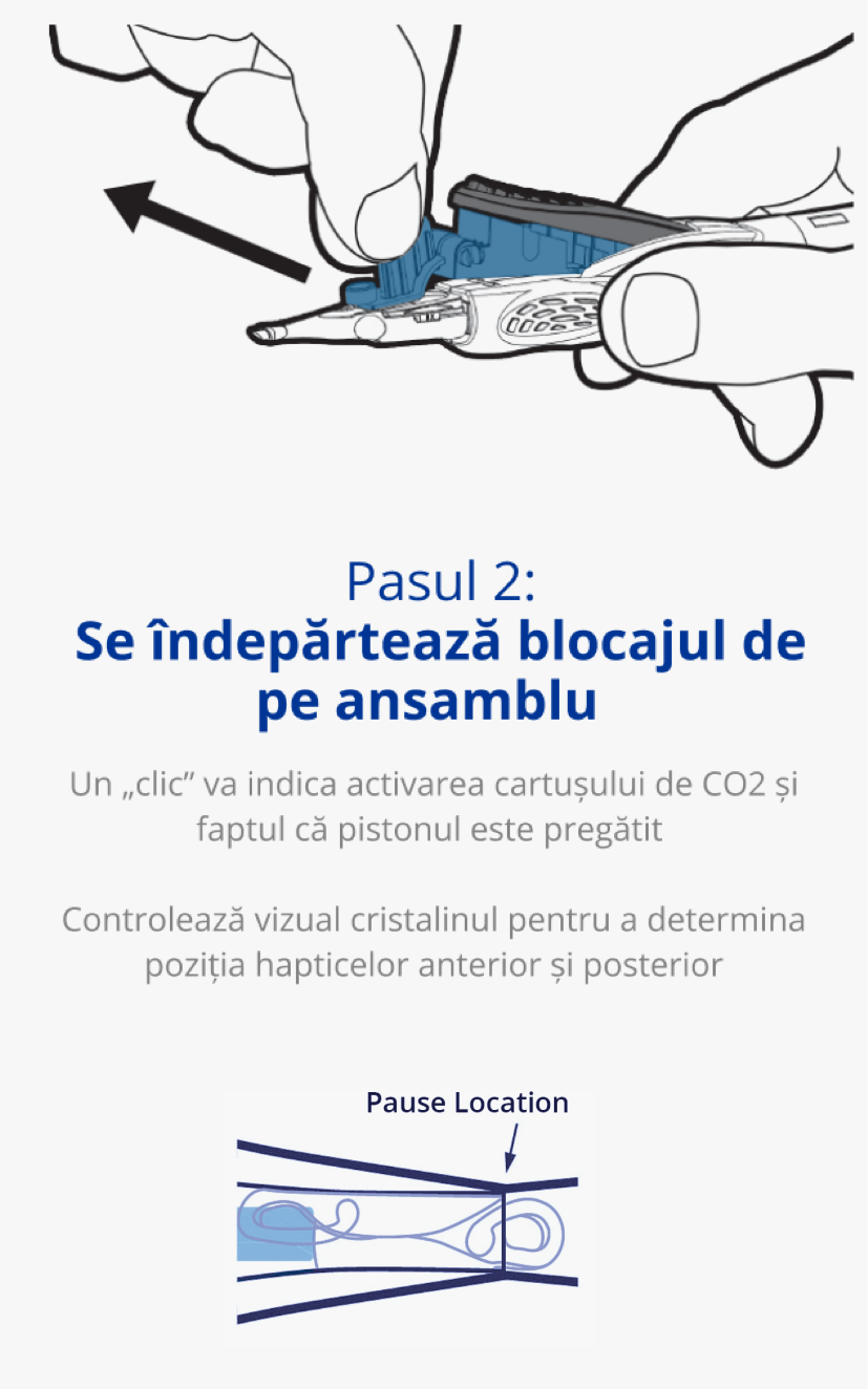 Illustration of an AutonoMe Delivery System’s plunger/cartridge piece. A dark blue arrow points towards the folded IOL in the AutonoMe cartridge with text that reads “Pause Location.”