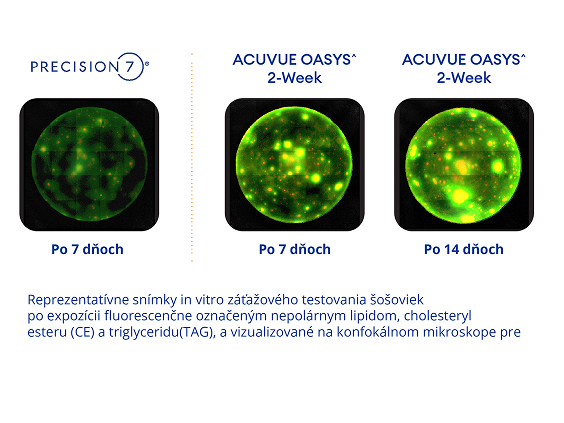 Porovnávacie mikroskopické snímky šošoviek: PRECISION7 po 7 dňoch vykazuje menej lipidových usadenín než ACUVUE OASYS po 7 dňoch a po 14 dňoch, zobrazené pomocou fluorescenčného značenia lipidov.