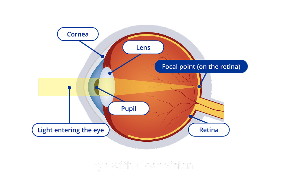 A diagram of the interior of an eye with clear vision. The diagram has yellow light entering the eye and the focal point of the light hits the retina. Certain areas of the eye are highlighted. These areas are the cornea, the lens, the pupil and the retina.