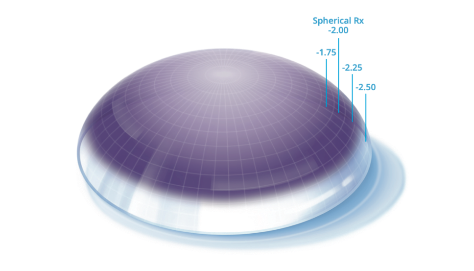 Precision profile