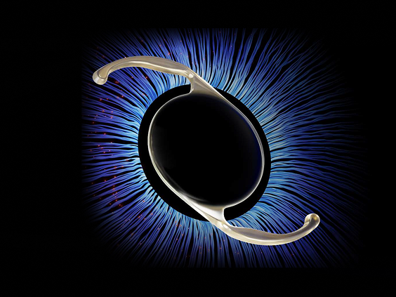 Clareon TruPlus intraocular lens against a blue iris background