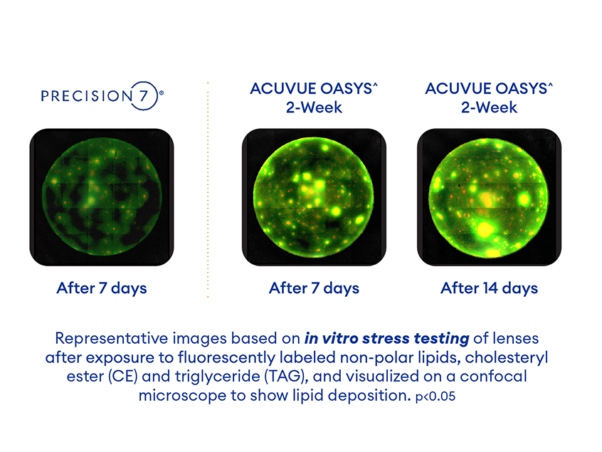 Fluorescence microscope images of contact lenses. PRECISION7 after 7 days shows fewer lipid deposits. ACUVUE OASYS after 7 and 14 days shows more lipid deposits.